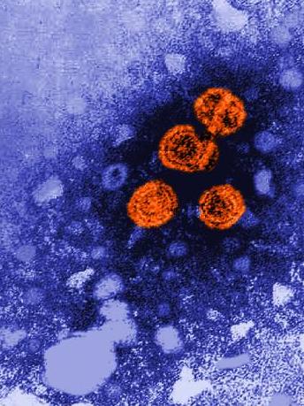 photo of a hepatitis b virus from cdc